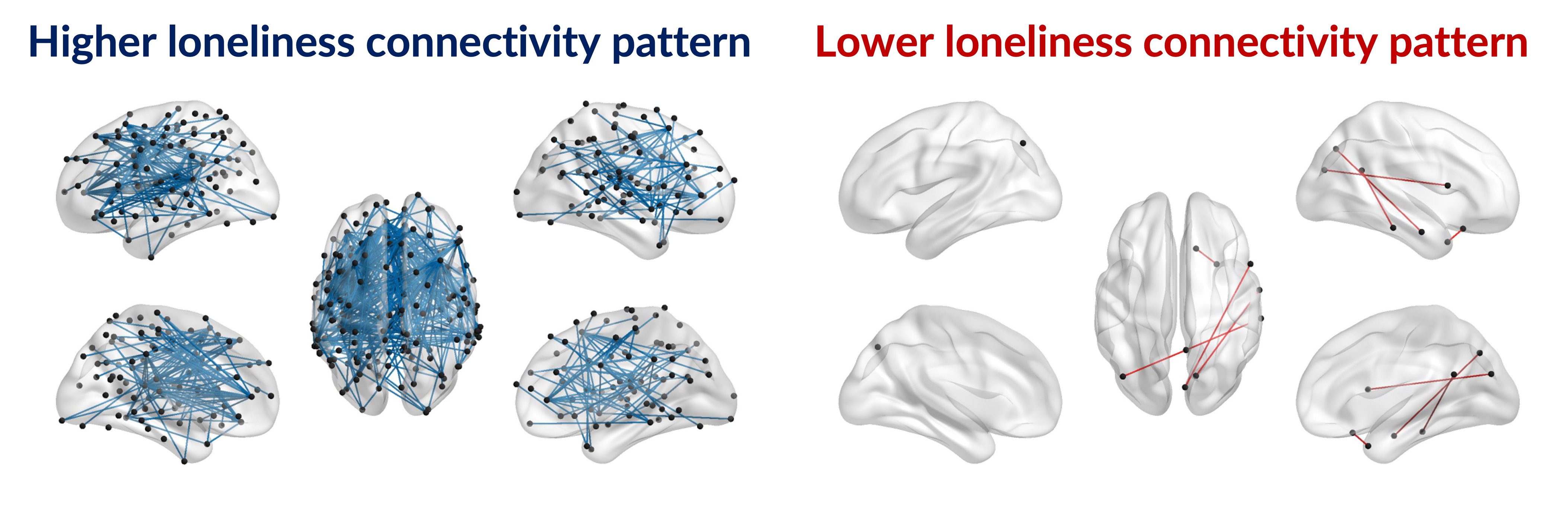 Illustration related to loneliness and interregional brain connectivity